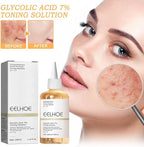 Toner for Face Skin - Free delivery