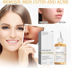 Toner for Face Skin - Free delivery